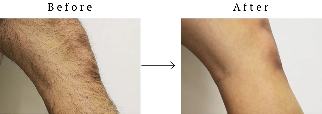 ビフォアアフター