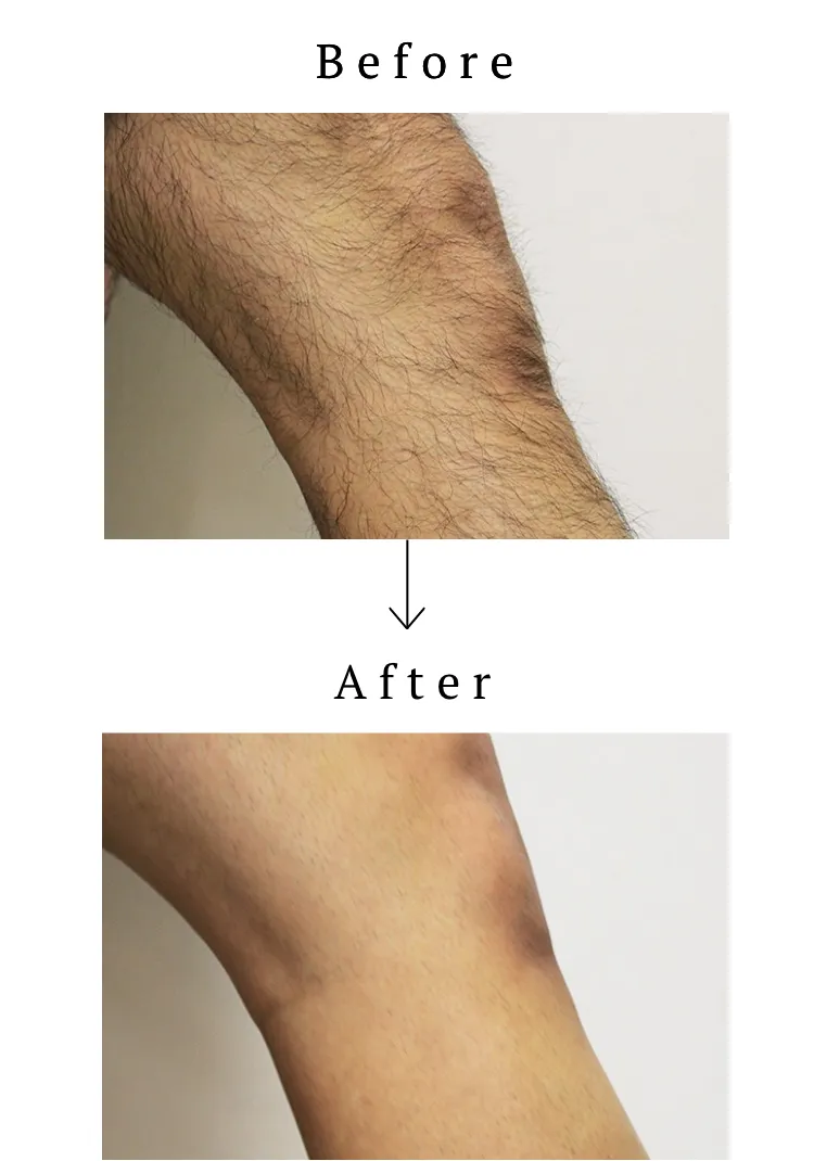 ビフォアアフター